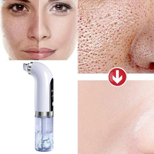 Blackhead Remover Pore Vacuum Cleaner Upgraded Blackhead Vacuum Rechargeable Face Vacuum Comedone Extractor-marginseye